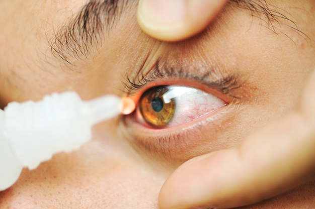 как лечить сухие глаза